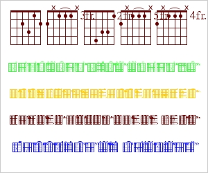 Frets