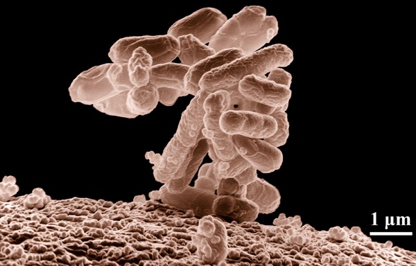 bacteria disease escherichia coli