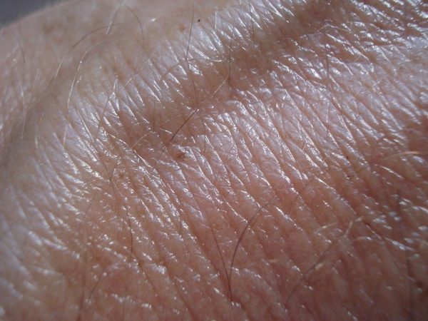 skin vein brown