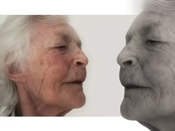 age dementia woman