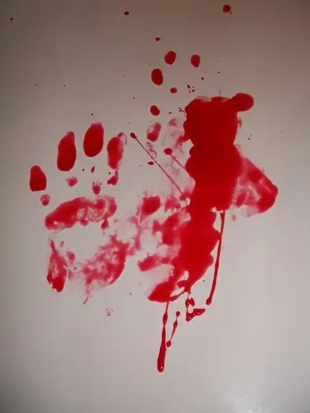 blood smears