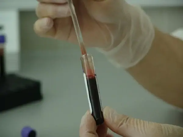 blood vial analysis