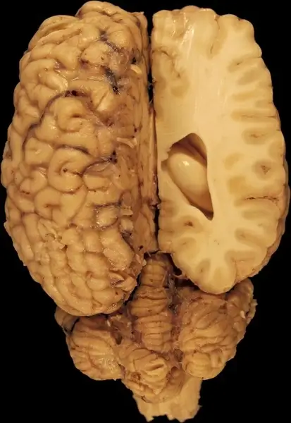 brain anatomy eyes