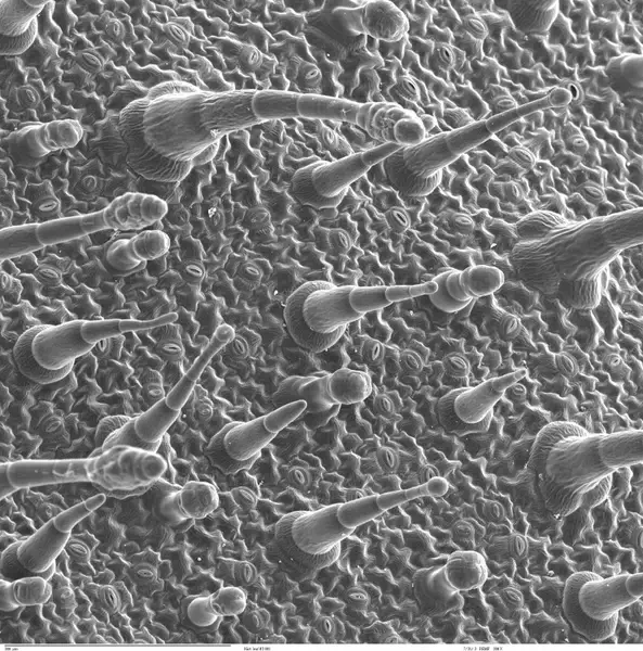 epidermis journal electron microscopy