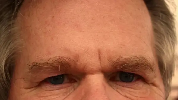 forehead eyes face