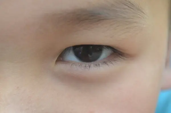 macro eye
