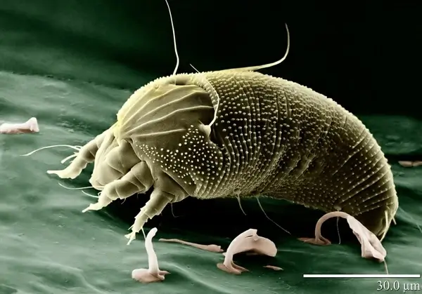 mite aceria anthocoptes acari