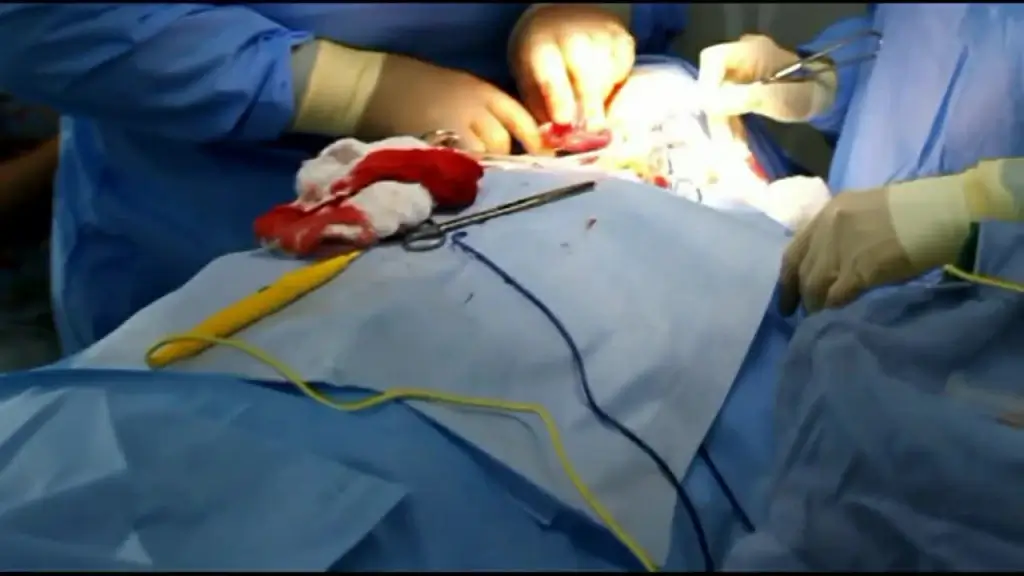 skillful hands of medical operation doctors