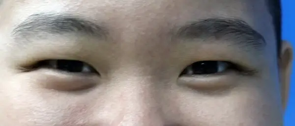 the eyes