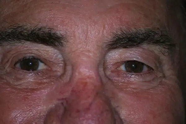 wise old eyes