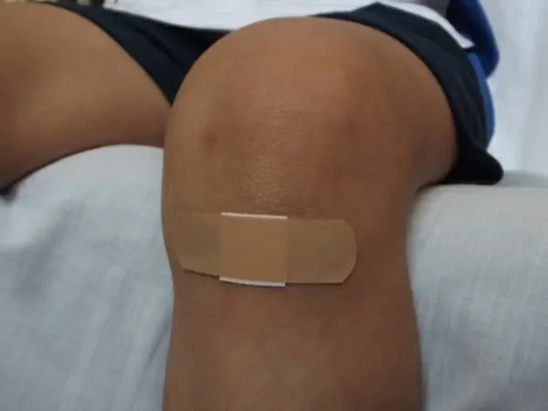 wound wounds wounded