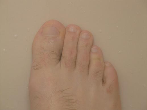foot bad part of the body