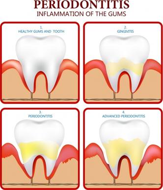 periodontics poster flat colored design tooth icons